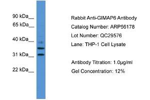 WB Suggested Anti-GIMAP6  Antibody Titration: 0. (GIMAP6 antibody  (C-Term))