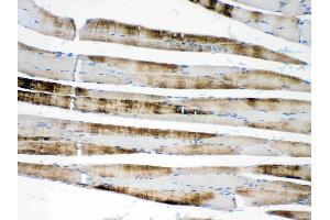 IHC analysis of ACTN3/Alpha Actinin 3 using anti- ACTN3/Alpha Actinin 3 antibody . (ACTN3 antibody  (C-Term))