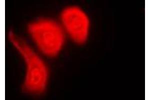 Immunofluorescent analysis of hnRNP K (pS284) staining in Raw264. (HNRNPK antibody  (pSer284))