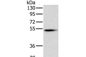 Western Blot analysis of Mouse pancreas tissue using PNLIP Polyclonal Antibody at dilution of 1:400 (PNLIP antibody)