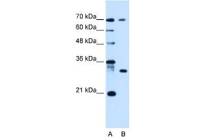 WB Suggested Anti-ATP6AP1L Antibody Titration:  0. (ATP6AP1L antibody  (C-Term))