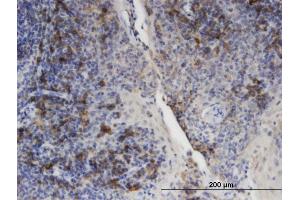 Immunoperoxidase of monoclonal antibody to PLIN3 on formalin-fixed paraffin-embedded human tonsil. (PLIN3 antibody  (AA 1-434))