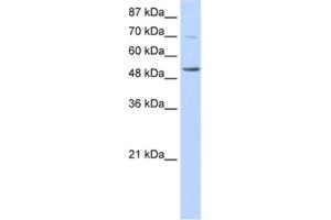 Western Blotting (WB) image for anti-IKAROS Family Zinc Finger 3 (Aiolos) (IKZF3) antibody (ABIN2461838) (IKZF3 antibody)