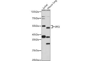 Western blot analysis of extracts of various cell lines, using (ABIN3023366, ABIN3023367, ABIN3023368 and ABIN6219659) at 1:1000 dilution.