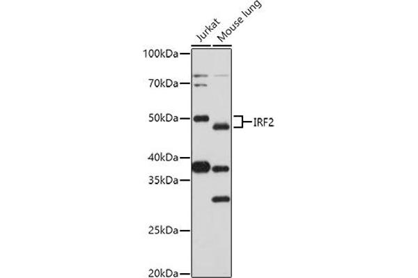 IRF2 抗体  (AA 120-349)
