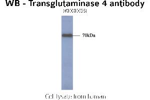 Image no. 1 for anti-Transglutaminase 4 (Prostate) (TGM4) antibody (ABIN347024) (TGM4 antibody)