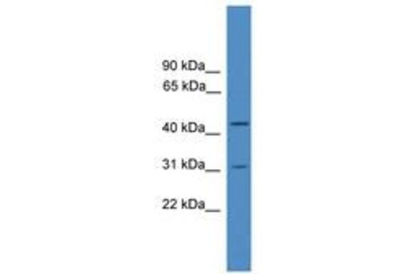 OTUD6A 抗体  (AA 81-130)