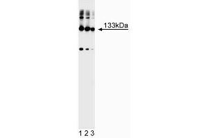 Western blot analysis of mGluR1alpha. (mGluR1 alpha antibody)