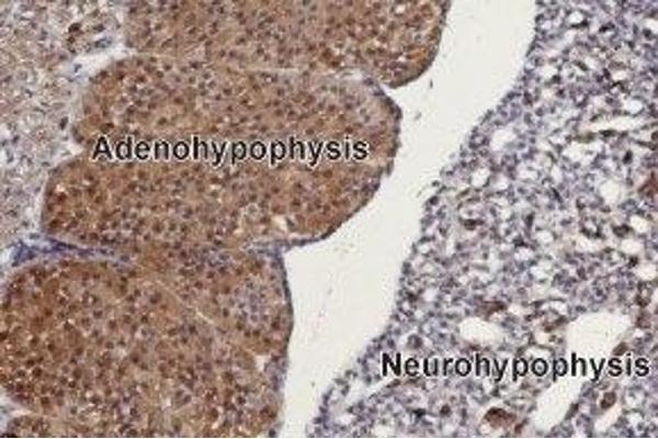 TRPC3 antibody  (C-Term, Intracellular)
