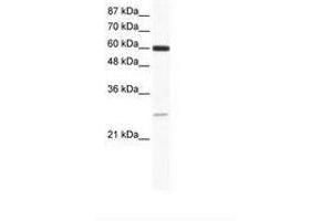 Image no. 1 for anti-ZFP91 Zinc Finger Protein (ZFP91) (AA 96-145) antibody (ABIN6736013) (ZFP91 antibody  (AA 96-145))