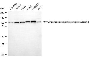 Western blotting analysis using anaphase promoting complex subunit 2 antibody (ABIN7797597). (ANAPC2 antibody)