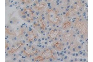 Detection of HPSE in Rat Kidney Tissue using Polyclonal Antibody to Heparanase (HPSE)