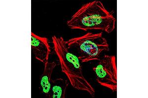 Fluorescent confocal image of Hela cell stained with TRIM28 Antibody (N-term) R. (KAP1 antibody  (N-Term))