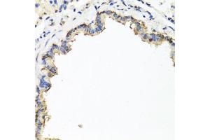Immunohistochemistry of paraffin-embedded rat lung using CXCR4 antibody (ABIN6292854) at dilution of 1:100 (40x lens).