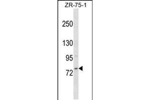Western blot analysis in ZR-75-1 cell line lysates (35ug/lane). (MICALCL antibody  (N-Term))