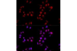 Immunofluorescence analysis of HeLa cells using HMGB1 antibody. (HMGB1 antibody  (AA 100-200))