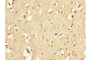 IHC image of ABIN7159059 diluted at 1:300 and staining in paraffin-embedded human brain tissue performed on a Leica BondTM system. (MGP antibody  (AA 20-96))
