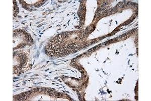 Immunohistochemistry (IHC) image for anti-Nitrilase Family, Member 2 (NIT2) antibody (ABIN1499737) (NIT2 antibody)