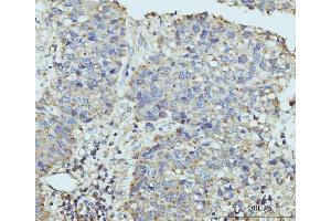 IHC analysis of HUPF2/RENT2/UPF2 using anti-HUPF2/RENT2/UPF2 antibody (ABIN7600567).