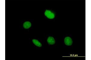 Immunofluorescence of purified MaxPab antibody to ZNF509 on HeLa cell. (ZBTB49 antibody  (AA 1-248))