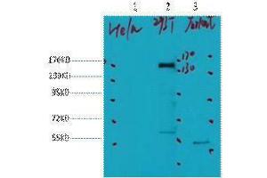 Western Blotting (WB) image for anti-Receptor tyrosine-protein kinase erbB-2 (ErbB2/Her2) antibody (ABIN3181149) (ErbB2/Her2 antibody)