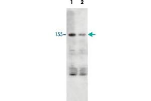 Western blot analysis of rat brain tissue lysate (10 mg/lane). (NOS1 antibody  (C-Term))
