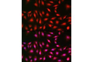 Immunofluorescence (IF) image for anti-Ribosomal Protein S6 Kinase, 70kDa, Polypeptide 1 (RPS6KB1) (AA 1-352) antibody (ABIN3023169)