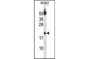 Western blot analysis of SAP18 Antibody (Center) Cat. (SAP18 antibody  (Middle Region))