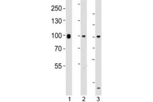 Western blot testing of Suz12 antibody at 1:1000 dilution. (SUZ12 antibody  (AA 496-530))