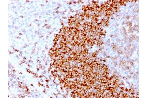 Formalin-fixed, paraffin-embedded human Tonsil stained with CD79b Recombinant Rabbit Monoclonal Antibody (IGB/3170R).