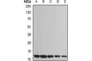 Western blot analysis of UBE2B expression in Jurkat (A), NIH3T3 (B), mouse heart (C), rat heart (D), rat brain (E) whole cell lysates.