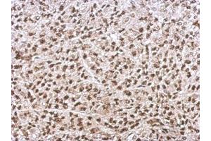 Immunohistochemistry (IHC) image for anti-X-Ray Repair Complementing Defective Repair in Chinese Hamster Cells 6 (XRCC6) (C-Term) antibody (ABIN2855186)