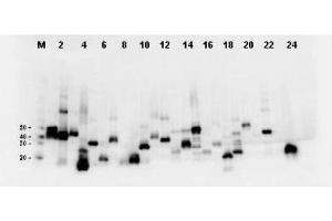 Twenty-four (24) clones were randomly selected and grown up from glycerol stocks by inoculating 0. (DYKDDDDK Tag antibody)