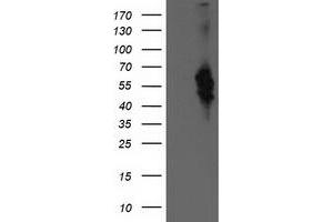Western Blotting (WB) image for anti-Bestrophin 3 (BEST3) antibody (ABIN1501730)