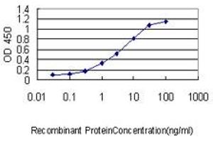 Detection limit for recombinant GST tagged SRF is approximately 0. (SRF antibody  (AA 406-508))