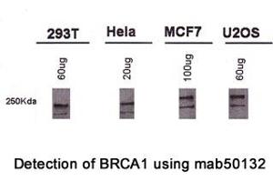 Image no. 1 for anti-Breast Cancer 1 (BRCA1) (AA 1314-1600), (AA 1314-1864) antibody (ABIN363286) (BRCA1 antibody  (AA 1314-1600, AA 1314-1864))