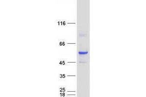 Validation with Western Blot (ALDH3A2 Protein (Transcript Variant 1) (Myc-DYKDDDDK Tag))