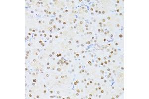 Immunohistochemistry of paraffin-embedded rat pancreas using ETV1 antibody (ABIN6291698) at dilution of 1:100 (40x lens).