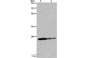 Western blot analysis of HT-29 cell and human fetal brain tissue, using GSTP1 Polyclonal Antibody at dilution of 1:350 (GSTP1 antibody)