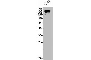 Western Blot analysis of HepG2 cells using PDGFR-α Polyclonal Antibody (PDGFRA antibody  (C-Term))