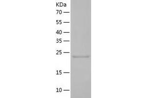 STAT6 Protein (AA 627-837) (His tag)