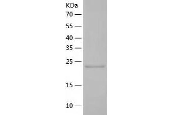 STAT6 Protein (AA 627-837) (His tag)