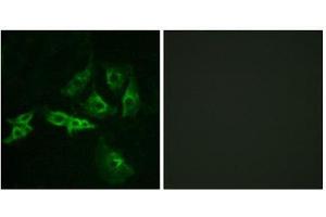 Immunofluorescence (IF) image for anti-Gonadotropin-Releasing Hormone Receptor (GNRHR) (Internal Region) antibody (ABIN1852969) (GNRHR antibody  (Internal Region))