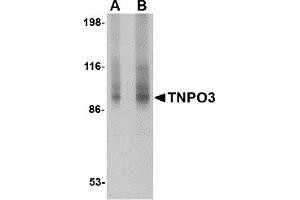 Western Blotting (WB) image for anti-Transportin 3 (TNPO3) (N-Term) antibody (ABIN1031695) (Transportin 3 antibody  (N-Term))