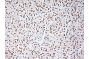 Immunohistochemical staining of paraffin-embedded colon tissue using anti-VEGFmouse monoclonal antibody. (VEGF antibody  (AA 27-233))