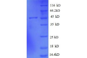 ADP-Ribosylation Factor-Like 2 Binding Protein (ARL2BP) (AA 1-163), (full length) protein (GST tag) (ARL2BP Protein (AA 1-163, full length) (GST tag))