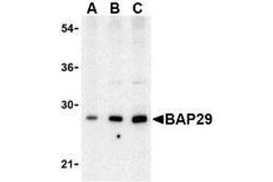 Western blot analysis of Bap29 in human heart tissue lysate with AP30120PU-N Bap29 antibody at (A) 0. (BCAP29 antibody  (Intermediate Domain))