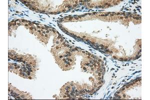 Immunohistochemical staining of paraffin-embedded liver tissue using anti-BSG mouse monoclonal antibody. (CD147 antibody)