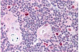 Human Thymus (formalin-fixed, paraffin-embedded) stained with AIRE antibody ABIN293603 at 2. (AIRE antibody  (AA 102-115))