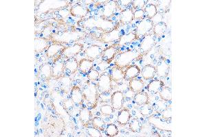 Immunohistochemistry of paraffin-embedded Mouse kidney using PDXP Rabbit pAb (ABIN7269758) at dilution of 1:100 (40x lens). (PDXP antibody  (C-Term))